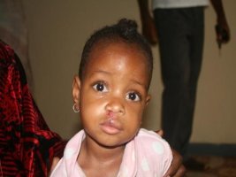 Kamerun-2013-Cleft