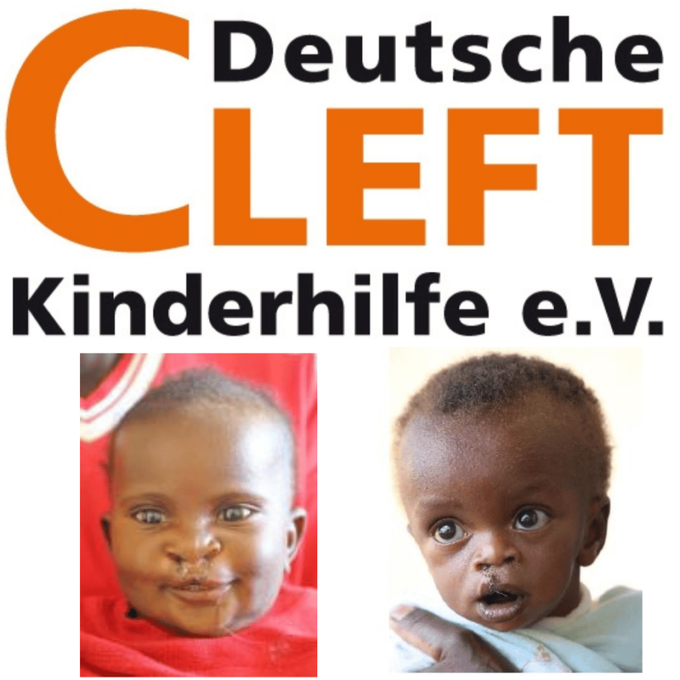 Ruanda-2014-Cleft Kinderhilfe e.V.